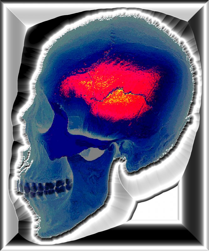 Skull framed in steel - by Tony Karp